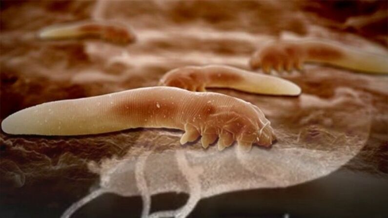 Parasiten
