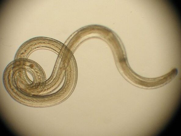 Trichinella als menschliche Parasitenart