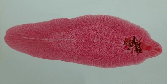 Trematodenwurm beim Menschen
