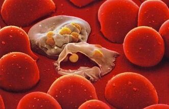Plasmodium aus Malaria im menschlichen Körper. 