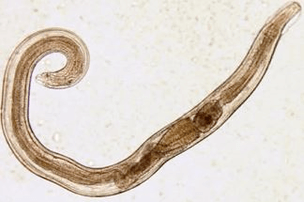 Madenwürmer im menschlichen Körper