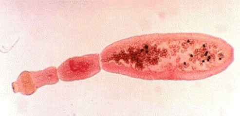 Wie sieht der Echinococcus auf dem menschlichen Körper aus 