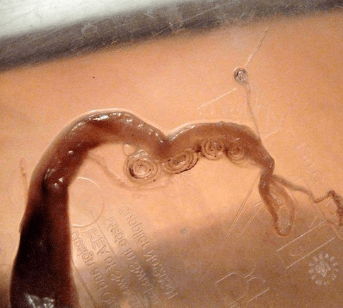 Wie sieht ein Zwergbandwurm auf dem menschlichen Körper aus 
